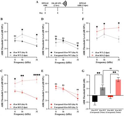 Absence of oncomodulin increases susceptibility to noise-induced outer hair cell death and alters mitochondrial morphology